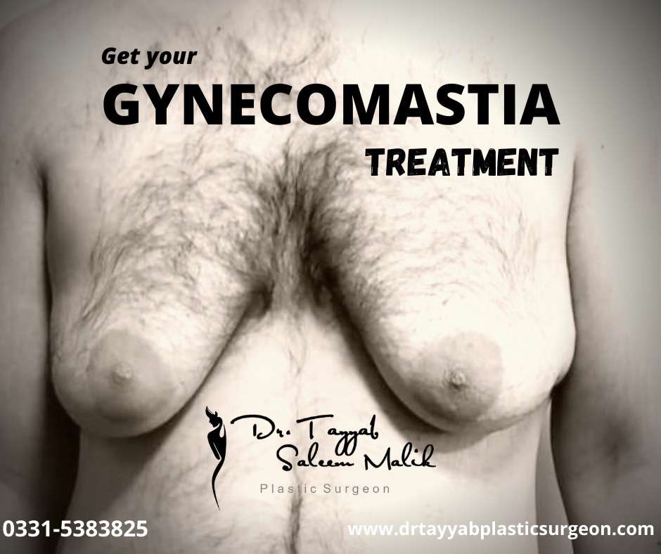 Gynecomastia (male breast)